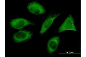 Immunofluorescence of monoclonal antibody to FLJ20643 on HeLa cell. (PIH1D1 antibody  (AA 1-290))