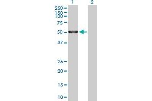 Western Blot analysis of MMP1 expression in transfected 293T cell line by MMP1 MaxPab polyclonal antibody. (MMP1 antibody  (AA 1-469))