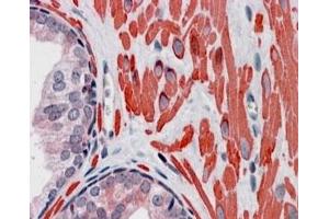 IHC staining of FFPE human prostate with VPS37C antibody at 4ug/ml. (VPS37C antibody)