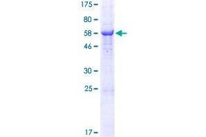 RDH10 Protein (AA 1-341) (GST tag)