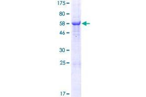 RDH10 Protein (AA 1-341) (GST tag)