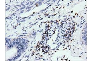 Immunohistochemical staining of paraffin-embedded Human colon tissue using anti-ARHGAP25 mouse monoclonal antibody.