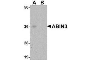 Western blot analysis of ABIN3 in human spleen tissue lysate with AP30005PU-N ABIN3 antibody at 1 μg/ml in (A) the absence and (B) the presence of blocking peptide.
