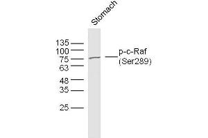 Mouse stomach lysates probed with c-Raf (Ser289) Polyclonal Antibody, unconjugated  at 1:300 overnight at 4°C followed by a conjugated secondary antibody at 1:10000 for 90 minutes at 37°C. (RAF1 antibody  (pSer289))