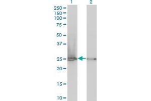 Western Blot analysis of RPL19 expression in transfected 293T cell line by RPL19 monoclonal antibody (M01), clone 3H4. (RPL19 antibody  (AA 1-100))