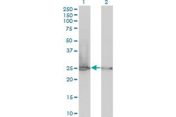 RPL19 Antikörper  (AA 1-100)