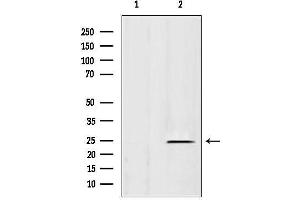 anti-Heat Shock Protein Family B (Small), Member 11 (HSPB11) (N-Term) antibody