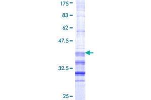 TCF21 Protein (AA 90-178) (GST tag)