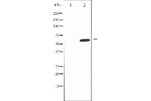 Western blot analysis of IL-10R alpha expression in Na2VO3 treated HepG2 whole cell lysates,The lane on the left is treated with the antigen-specific peptide. (IL-10RA antibody  (C-Term))