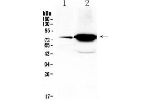 Western blot analysis of FSH Receptor using anti- FSH Receptor antibody . (FSHR antibody  (Middle Region))