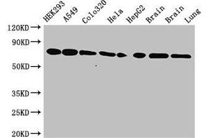 Western Blot Positive WB detected in: HEK293 whole cell lysate, A549 whole cell lysate, Colo320 whole cell lysate, Hela whole cell lysate, HepG2 whole cell lysate, Mouse brain tissue, Rat brain tissue, Rat lung tissue All lanes: HSPA8 antibody at 3. (Hsc70 antibody  (AA 418-597))