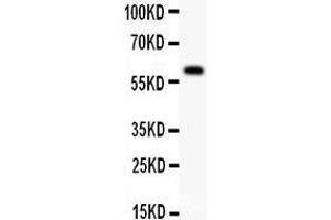 Anti- DR3 antibody, Western blotting All lanes: Anti DR3  at 0.