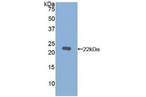 Detection of Recombinant MMP12, Human using Polyclonal Antibody to Matrix Metalloproteinase 12 (MMP12) (MMP12 antibody  (AA 290-469))