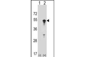 Western blot analysis of ST (arrow) using rabbit polyclonal ST Antibody (D10) (ABIN1882134 and ABIN2839215). (STAM antibody  (N-Term))