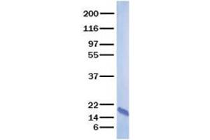 Validation with Western Blot (CXCL14 Protein)