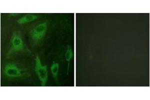 Immunofluorescence (IF) image for anti-Aquaporin 2 (Collecting Duct) (AQP2) (AA 222-271) antibody (ABIN2888757) (AQP2 antibody  (AA 222-271))