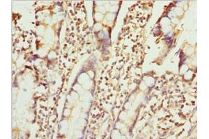Immunohistochemistry of paraffin-embedded human small intestine tissue using ABIN7176126 at dilution of 1:100 (ZNF169 antibody  (AA 1-85))