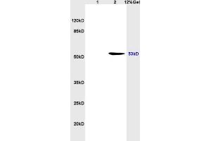 SDS-PAGE (SDS) image for anti-Tumor Protein P53 (TP53) (AA 251-310) antibody (ABIN723935)