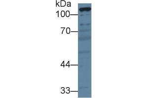 Detection of PC in Porcine Liver lysate using Polyclonal Antibody to Pyruvate Carboxylase (PC) (PC antibody  (AA 36-486))
