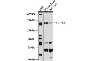 Western blot analysis of extracts of various cell lines, using SLITRK6 antibody (ABIN6130698, ABIN6148072, ABIN6148073 and ABIN6220277) at 1:1000 dilution. (SLITRK6 antibody  (AA 621-816))