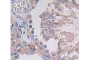 Used in DAB staining on fromalin fixed paraffin- embedded Kidney tissue (TUBE1 antibody  (AA 225-472))