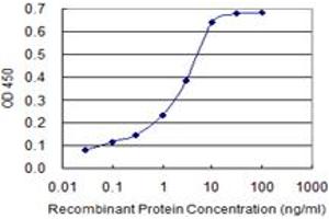 Detection limit for recombinant GST tagged IL1B is 0. (IL-1 beta antibody  (AA 1-269))