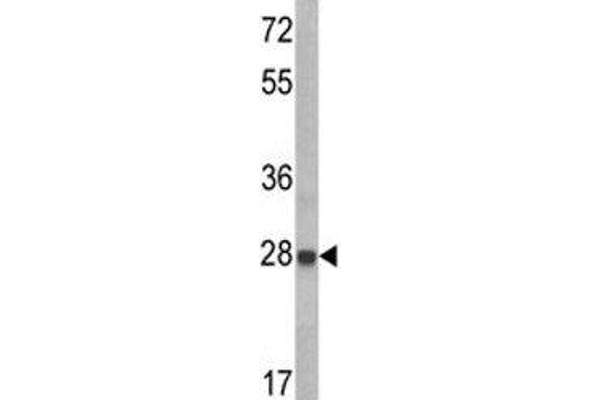 IGFBP6 Antikörper  (AA 176-200)
