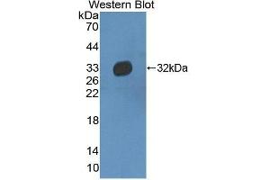Western Blotting (WB) image for anti-Haptoglobin Related Protein (HPR) (AA 102-347) antibody (ABIN3205656) (HPR antibody  (AA 102-347))