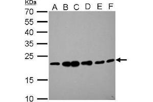 WB Image RAMP2 antibody detects RAMP2 protein by Western blot analysis. (RAMP2 antibody  (C-Term))