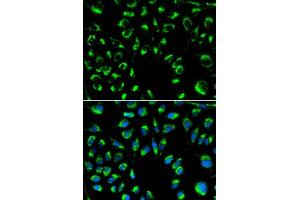 Immunofluorescence analysis of MCF-7 cells using PPP4C antibody (ABIN5971135). (PPP4C antibody)