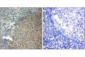Immunohistochemistry analysis of paraffin-embedded human tonsil tissue, using BLNK (Ab-96) Antibody. (B-Cell Linker antibody  (AA 62-111))
