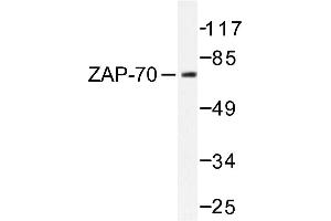 Image no. 1 for anti-zeta-Chain (TCR) Associated Protein Kinase 70kDa (ZAP70) antibody (ABIN272095) (ZAP70 antibody)
