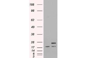 HEK293 overexpressing Human PGRMC1 and probed with ABIN2564496 (mock transfection in first lane). (PGRMC1 antibody  (C-Term))