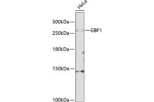 Western blot analysis of extracts of HeLa cells, using GBF1 Antibody (ABIN6132031, ABIN6140994, ABIN6140996 and ABIN6216201) at 1:1000 dilution. (GBF1 antibody  (AA 1-85))