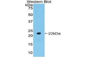Western Blotting (WB) image for anti-POTE Ankyrin Domain Family, Member G (POTEG) (AA 146-306) antibody (ABIN1171743) (POTEG antibody  (AA 146-306))