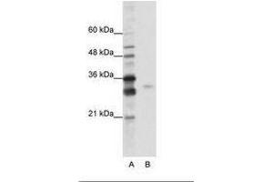 Image no. 1 for anti-serine/arginine-Rich Splicing Factor 1 (SRSF1) (AA 161-210) antibody (ABIN6736207) (SRSF1 antibody  (AA 161-210))