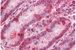 Human Small Intestine: Formalin-Fixed, Paraffin-Embedded (FFPE) (ZNF687 antibody  (C-Term))