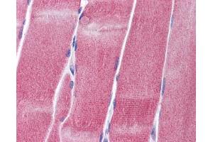 Immunohistochemistry (IHC) image for anti-Potassium Voltage-Gated Channel, Shaw-Related Subfamily, Member 4 (KCNC4) (Middle Region) antibody (ABIN2776170) (Kv3.4 antibody  (Middle Region))