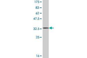 Western Blot detection against Immunogen (35. (TWIST2 antibody  (AA 54-140))