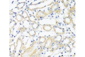 Immunohistochemistry of paraffin-embedded Mouse kidney using CTGF Polyclonal Antibody at dilution of 1:100 (40x lens). (CTGF antibody)