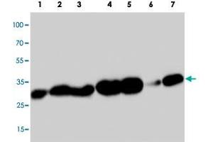 Western blot analysis of tissue extracts with PDPN polyclonal antibody . (Podoplanin antibody  (C-Term))