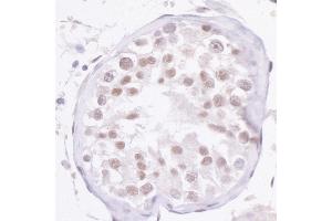 anti-Nuclear Receptor Coactivator 2 (NCOA2) (C-Term) antibody