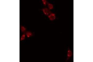 ABIN6277029 staining HuvEC by IF/ICC. (CD70 antibody  (Internal Region))