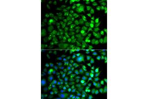 Immunofluorescence analysis of A549 cell using OSGEP antibody. (OSGEP antibody)