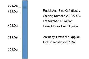 Western Blotting (WB) image for anti-SMEK Homolog 2, Suppressor of Mek1 (Dictyostelium) (SMEK2) (C-Term) antibody (ABIN2787220) (SMEK2 antibody  (C-Term))