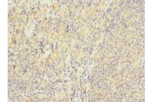 Immunohistochemistry of paraffin-embedded human tonsil tissue using ABIN7175617 at dilution of 1:100 (HVCN1 antibody  (AA 1-100))