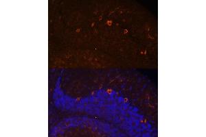 Immunofluorescence (IF) image for anti-Kallmann Syndrome 1 Sequence (KAL1) (AA 200-300) antibody (ABIN7268068)