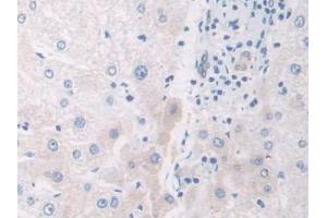 IHC-P analysis of Human Liver Tissue, with DAB staining. (IL12A antibody  (AA 23-219))