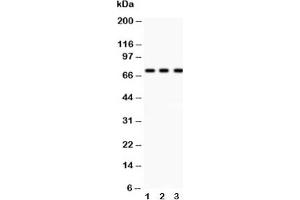 Western blot testing of p73 antibody and Lane 1:  COLO320;  2: MCF-7;  3: HeLa lysate