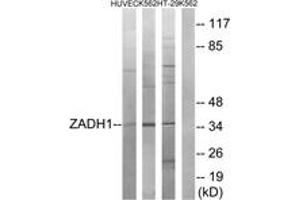 Western blot analysis of extracts from K562/HuvEc/HT-29 cells, using ZADH1 Antibody.
